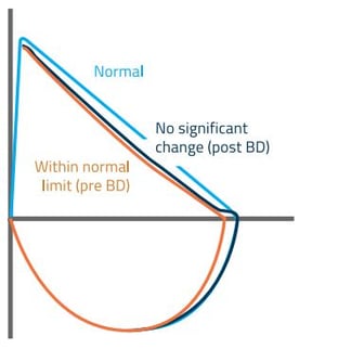 Figure 1_MiniBox